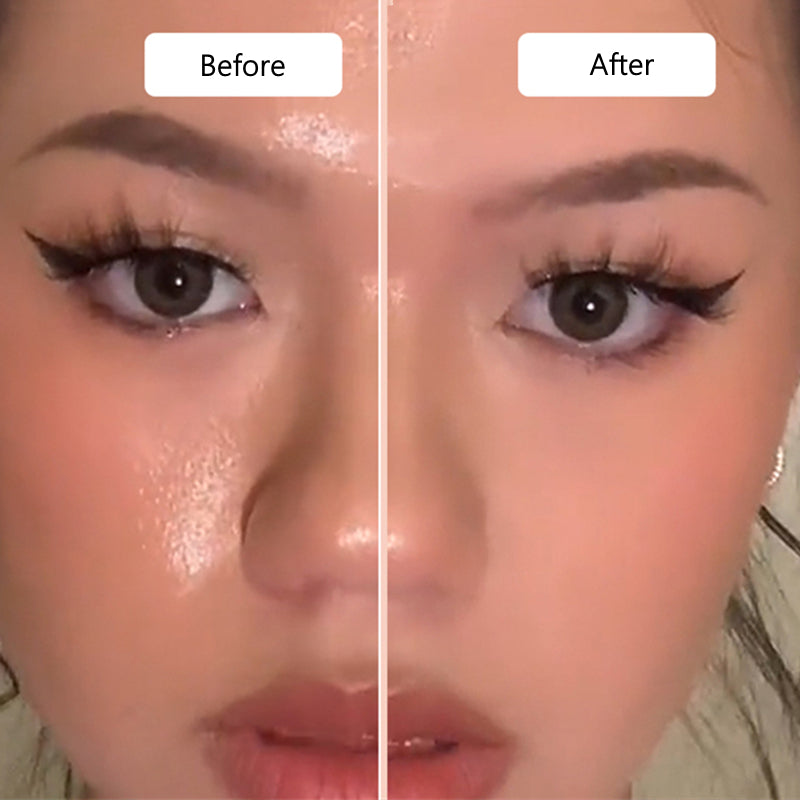 VOLCANICPURE™ OIL-ABSORBING FACE ROLLER